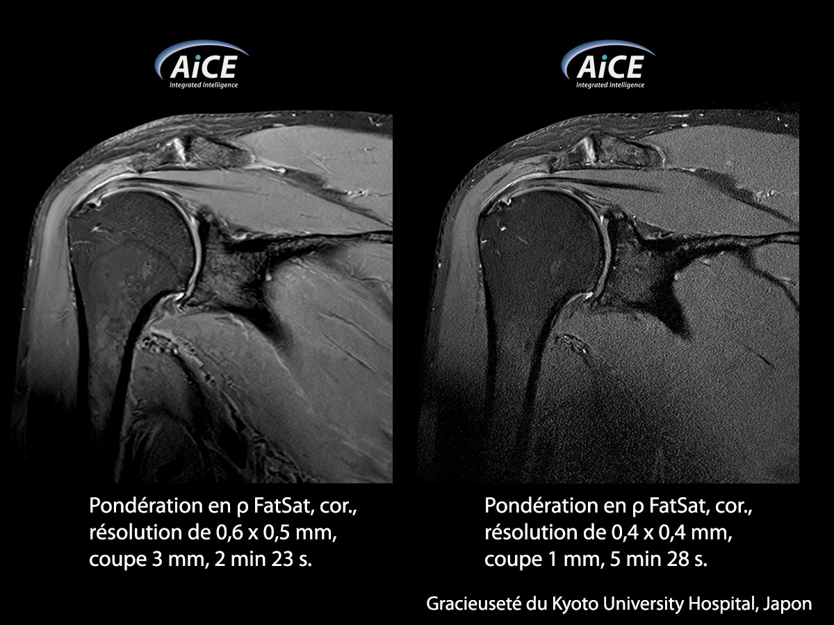 Aice 3t Musculosquelettique 1