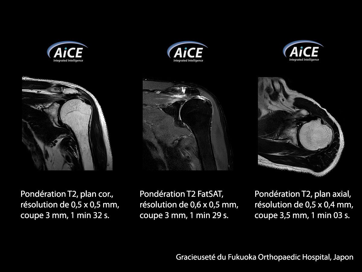 Aice 3t Musculosquelettique 1