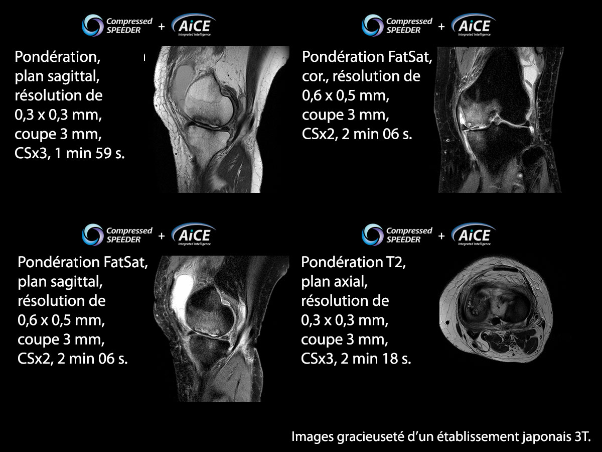 Aice 3t Musculosquelettique 2