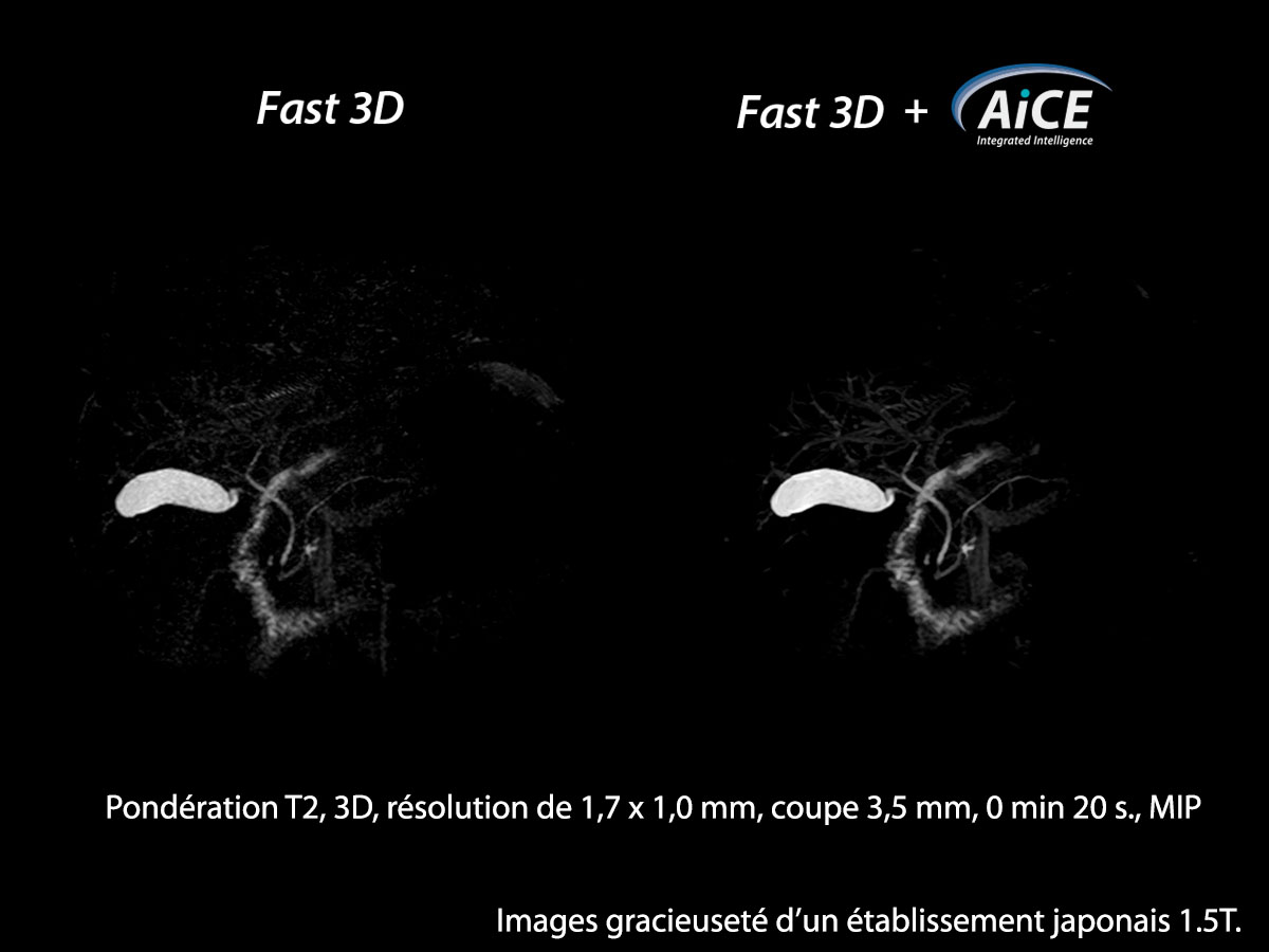Aice Clinical Gallery Abdomen