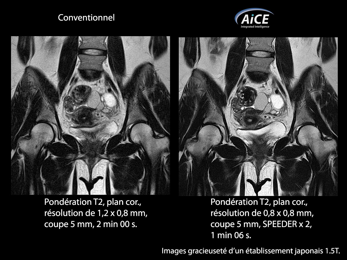 Aice Clinical Gallery Abdomen
