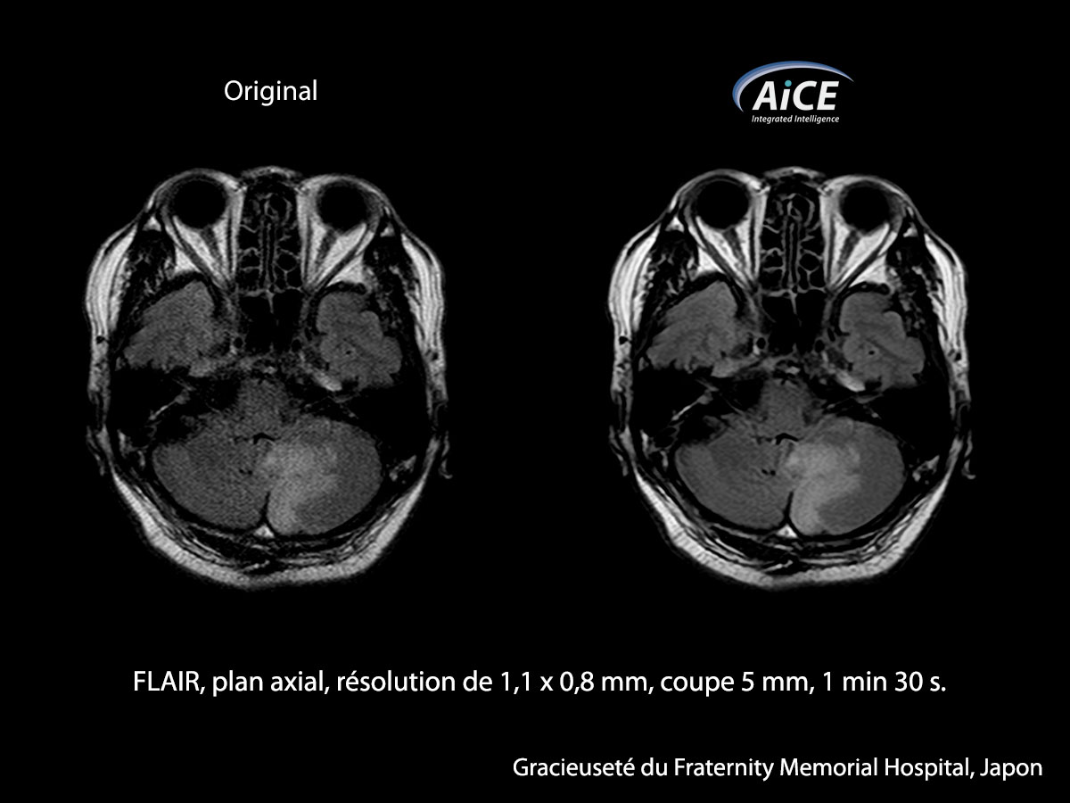Aice Clinical Gallery La tête