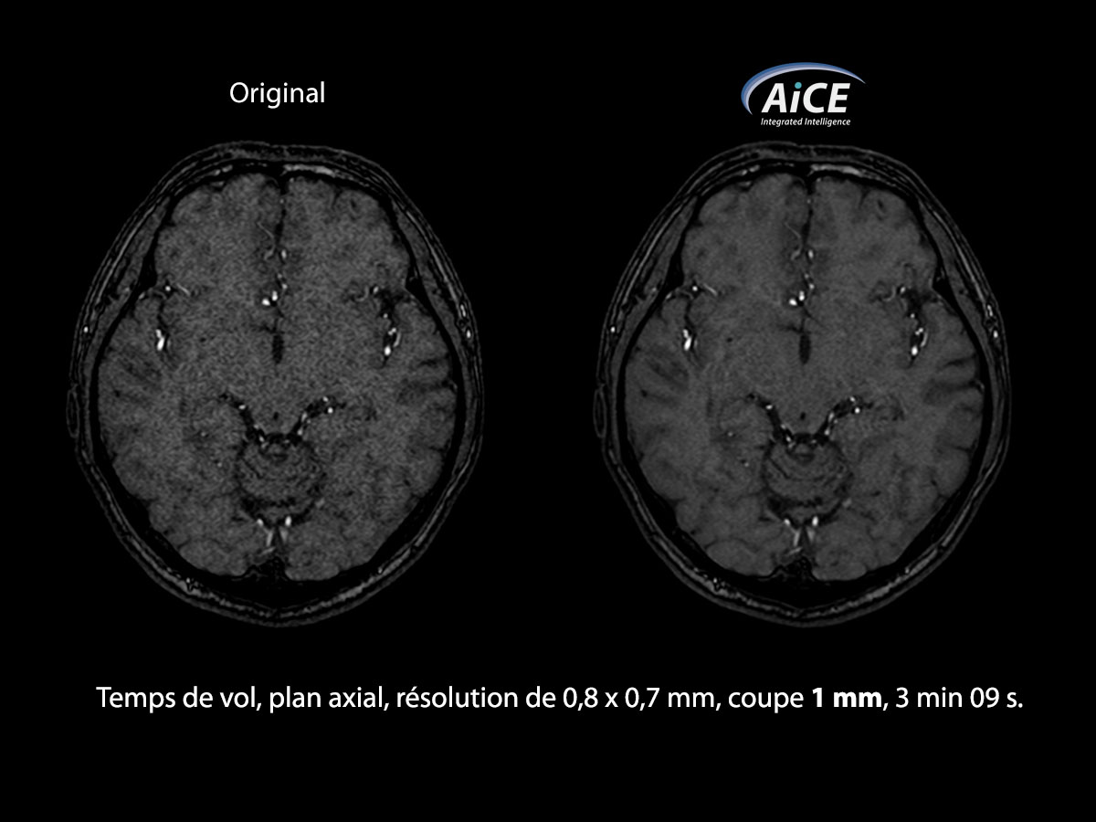 Aice Clinical Gallery La tête