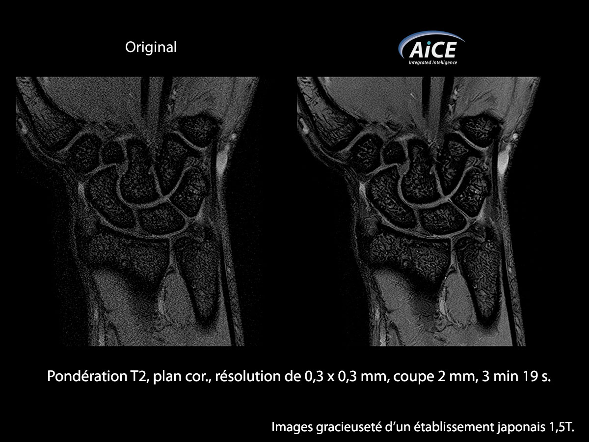Aice Clinical Gallery Musculosquelettique