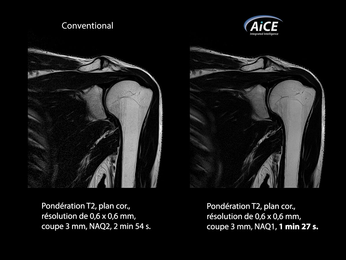 Aice Clinical Gallery Musculosquelettique