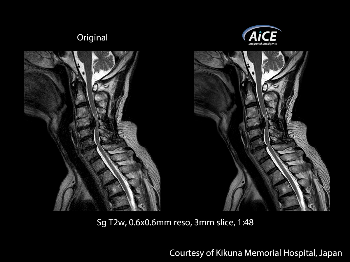 Spine
