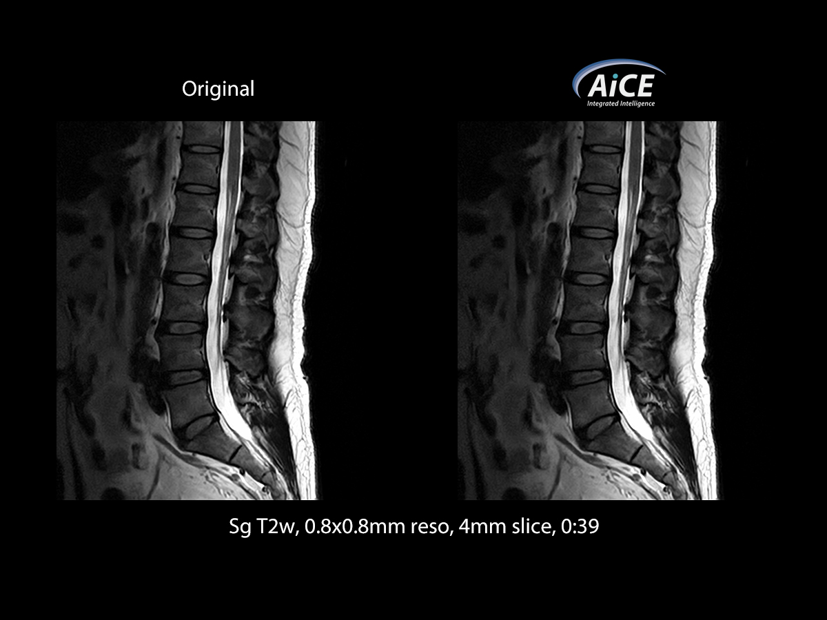 Spine