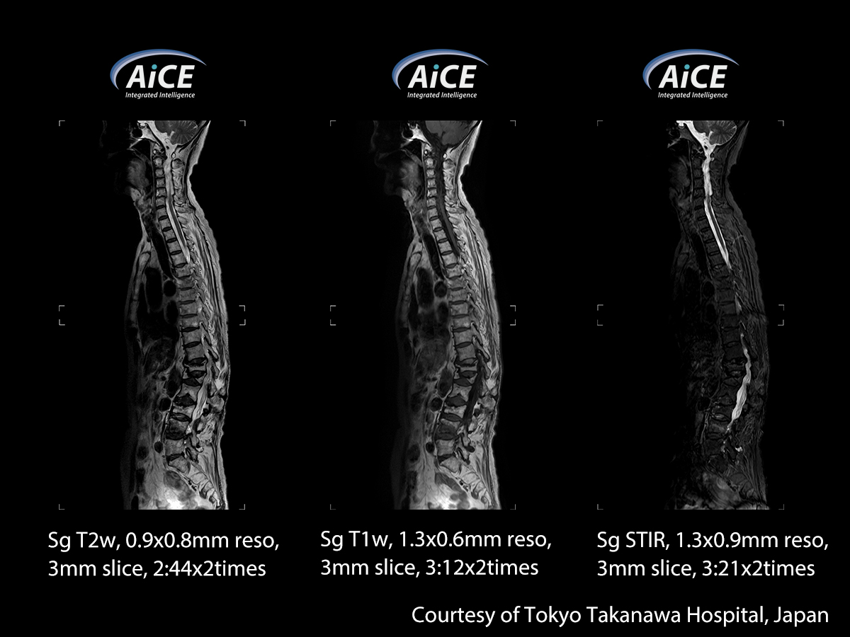 Spine
