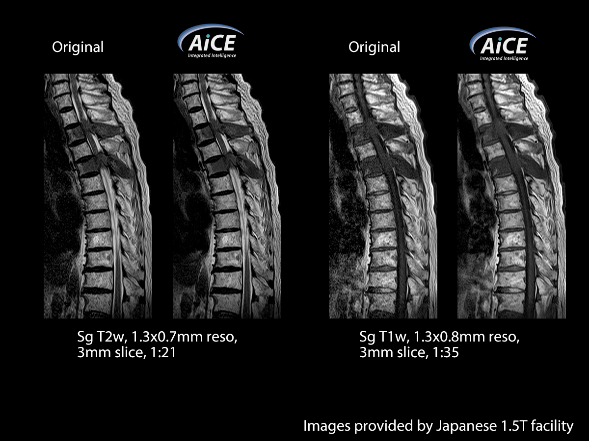 Spine