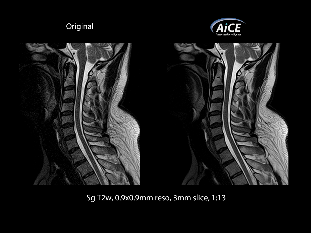 Spine