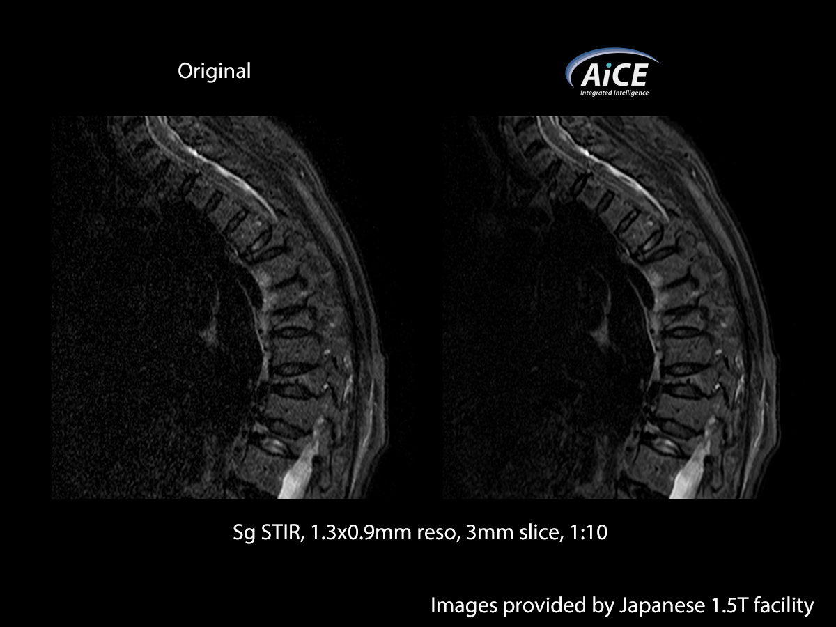 Spine
