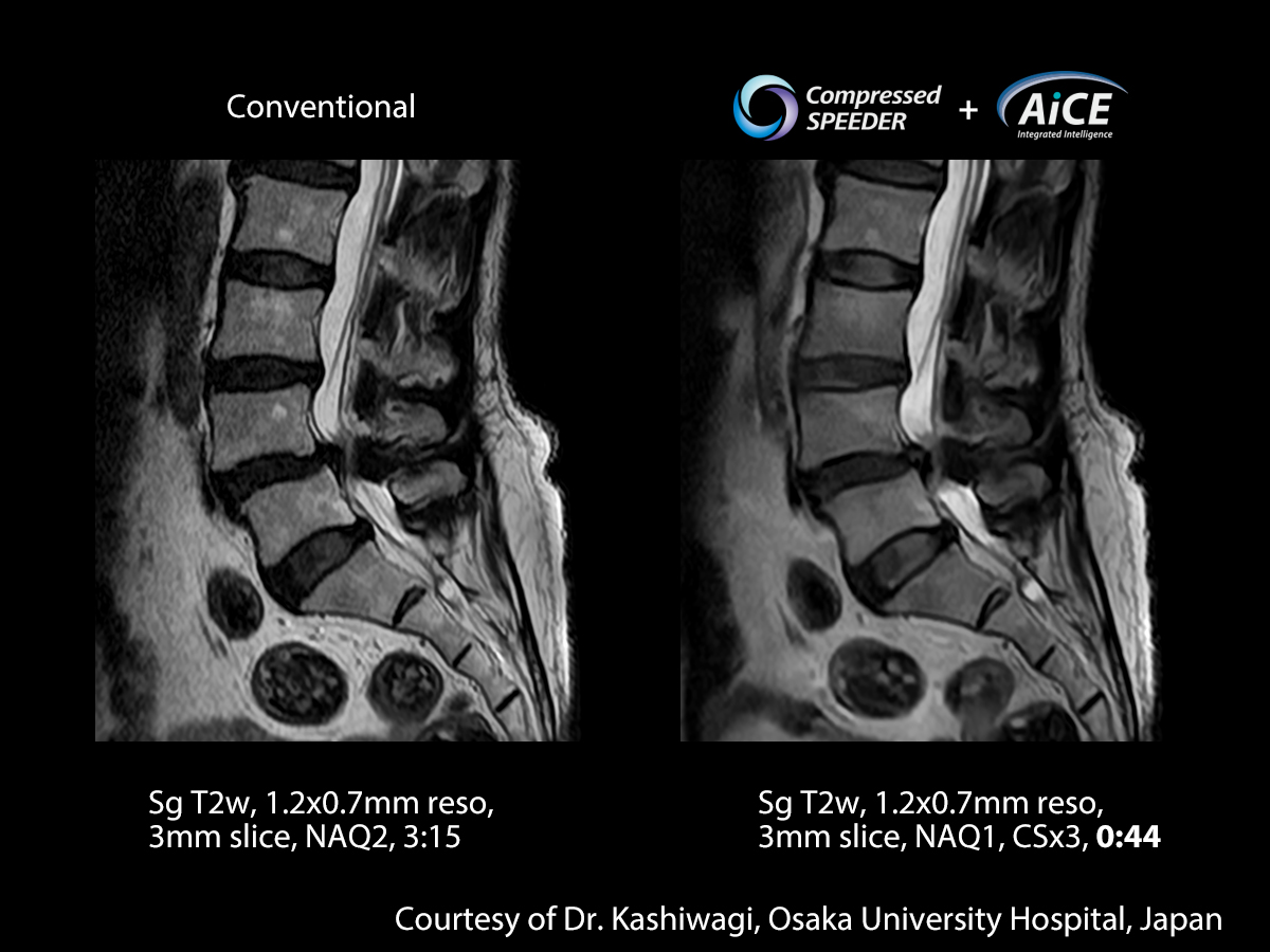 Spine