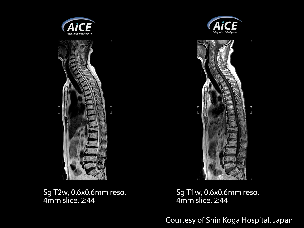 Spine