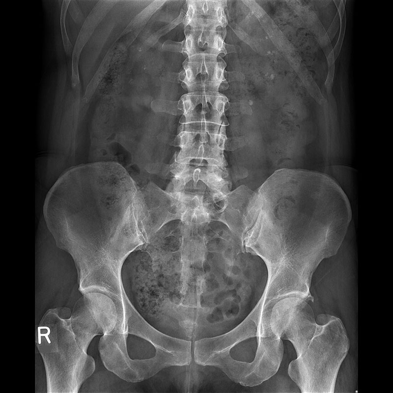 Systèmes de radiographie numérique CXDI Abdomen, gastro-intestinale