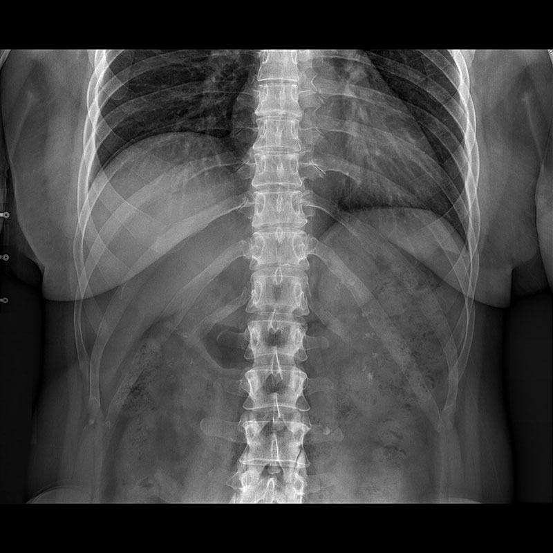 Systèmes de radiographie numérique CXDI Abdomen, gastro-intestinale