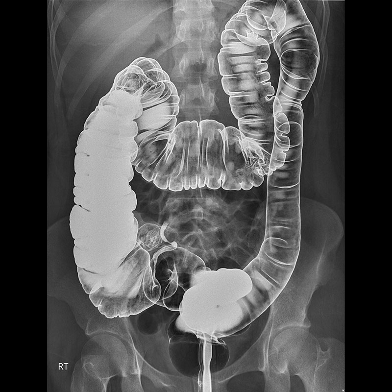 Systèmes de radiographie numérique CXDI Abdomen, gastro-intestinale