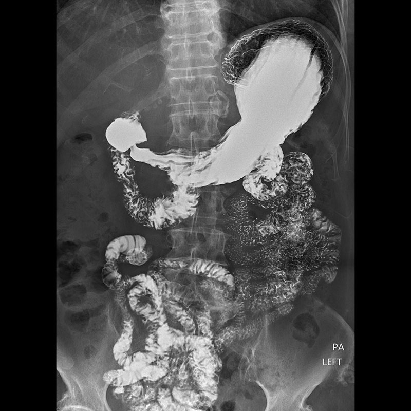 Systèmes de radiographie numérique CXDI Abdomen, gastro-intestinale