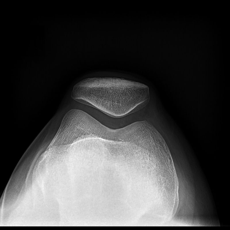 Systèmes de radiographie numérique CXDI Genou