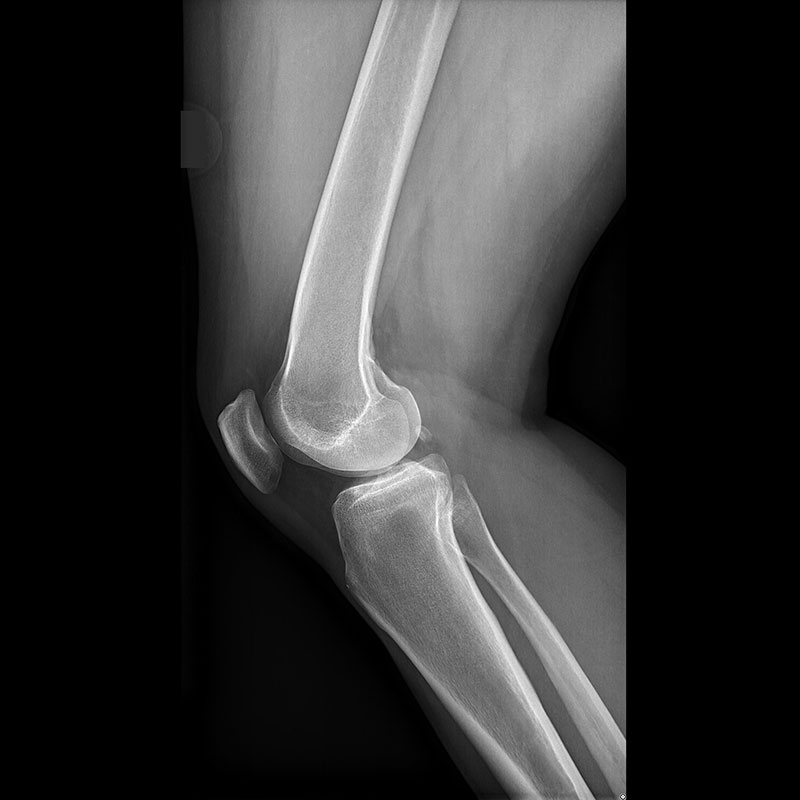 Systèmes de radiographie numérique CXDI Genou