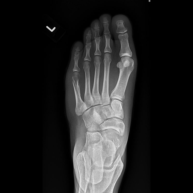Systèmes de radiographie numérique CXDI Pied