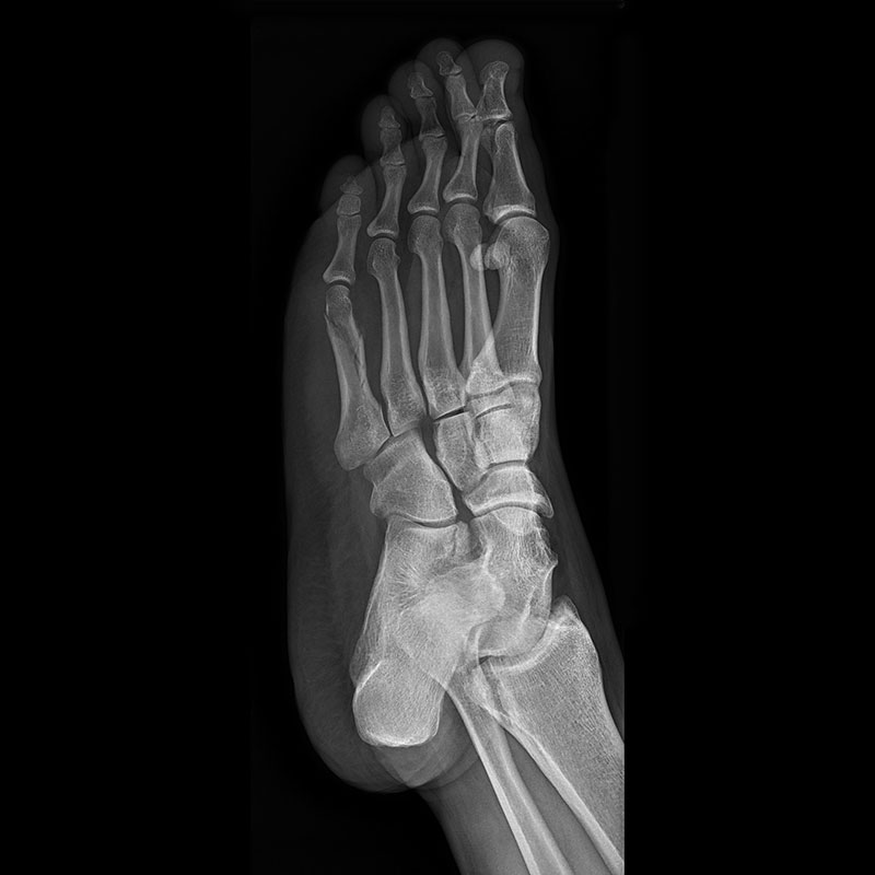 Systèmes de radiographie numérique CXDI Pied