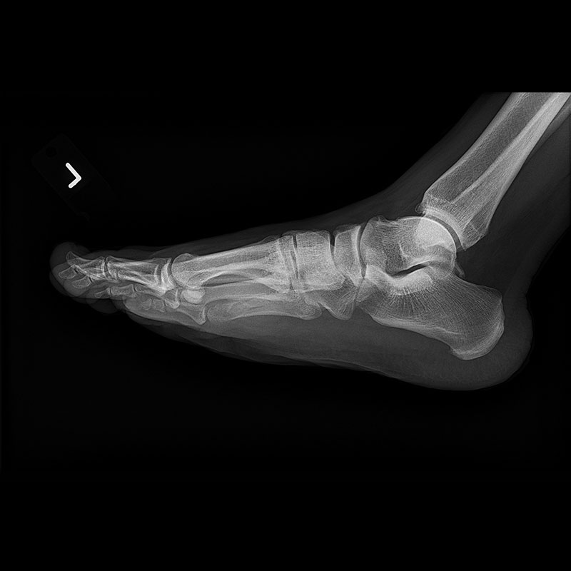 Systèmes de radiographie numérique CXDI Pied