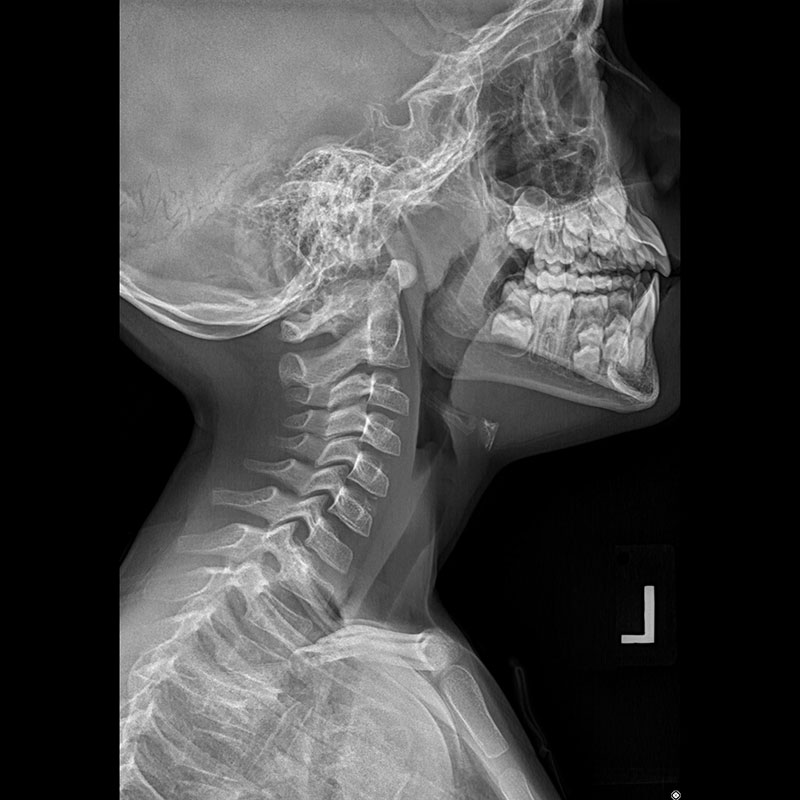 Systèmes de radiographie numérique CXDI Imagerie pédiatrique