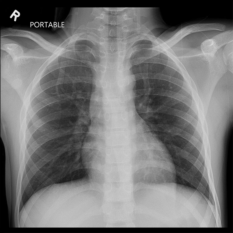 Systèmes de radiographie numérique CXDI Imagerie pédiatrique