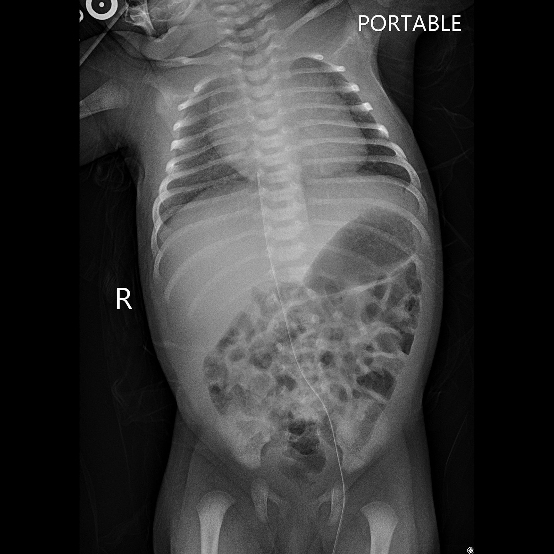 Systèmes de radiographie numérique CXDI Imagerie pédiatrique