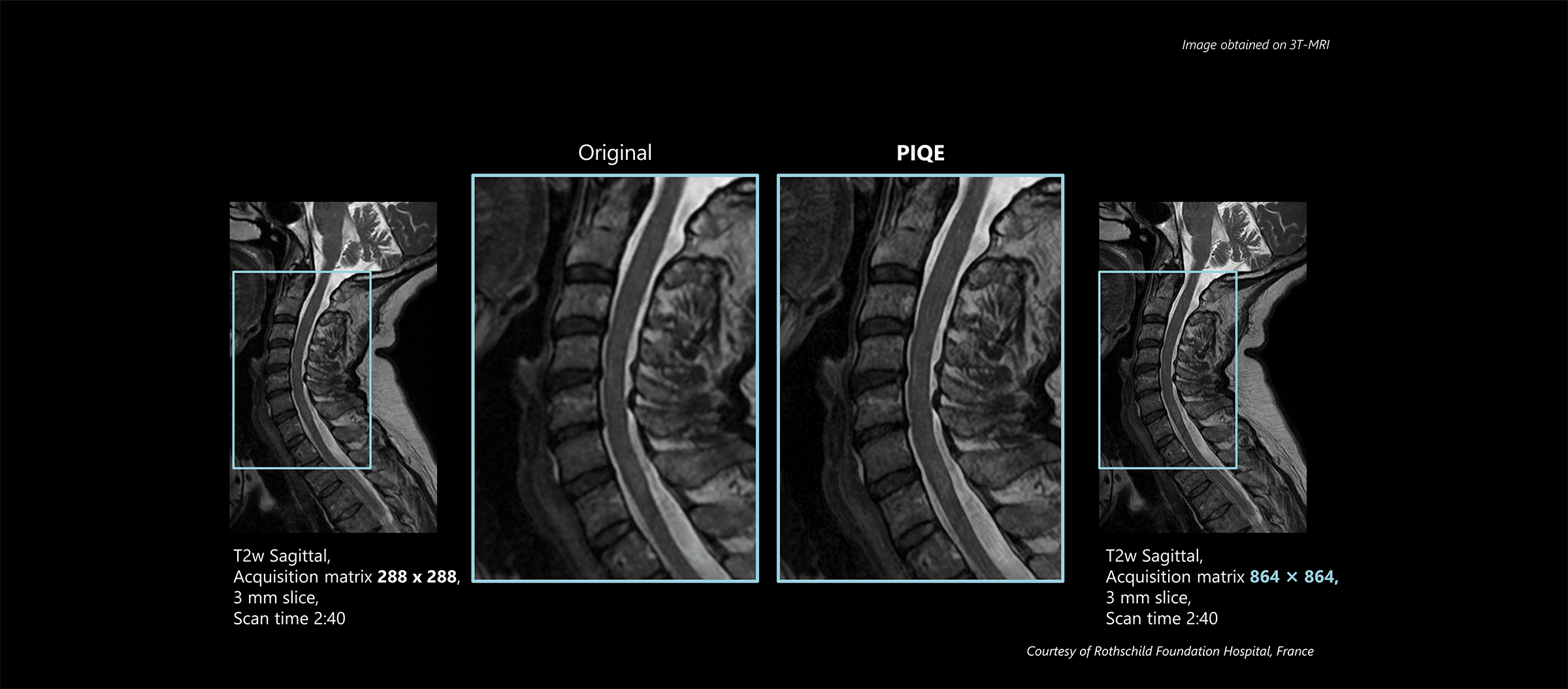 Spine